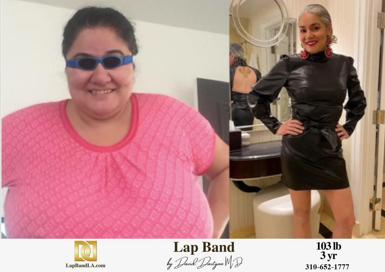 LapBandLA.com